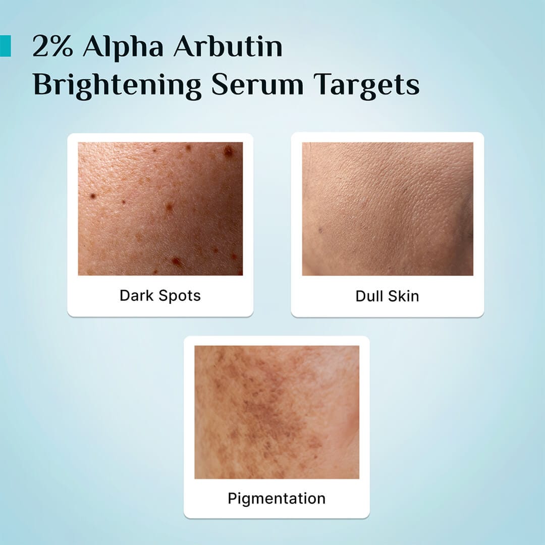 2% Alpha Arbutin Brightening Serum